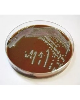 ПЕПТОН МАРТЕНА